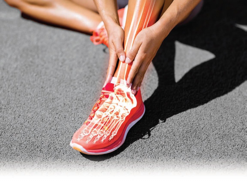 تصویر استخوانهای پا در دونده دچار پا درد