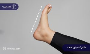 علائم کف پای صاف