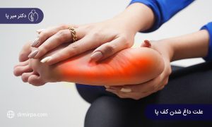 علت داغ شدن کف پا