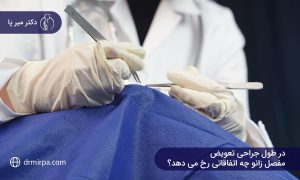 در طول جراحی تعویض مفصل زانو چه اتفاقاتی رخ می دهد؟