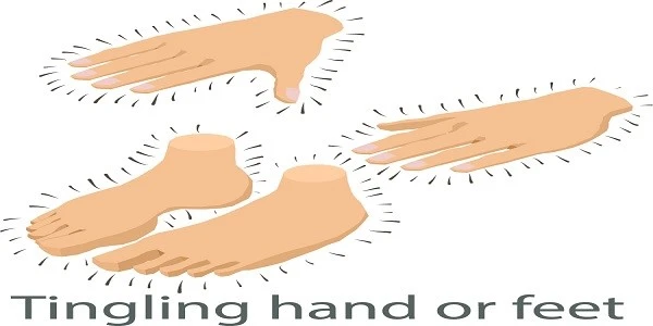 Tingling-hands-feet