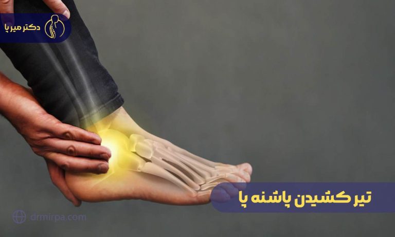 تیر کشیدن پاشنه پا
