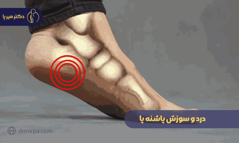 درمان سریع و مؤثر درد و سوزش پاشنه پا با روش‌های ساده
