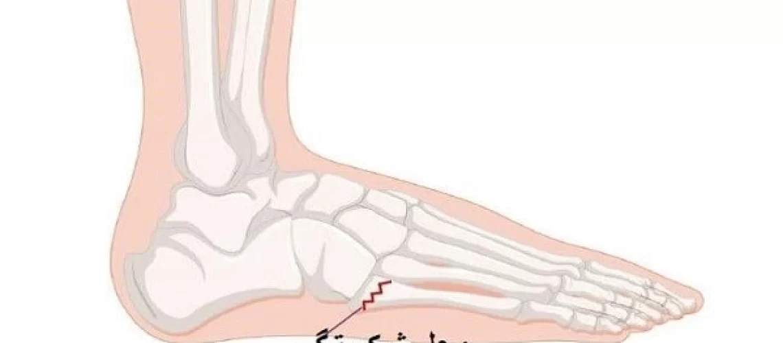 Doctor_foot_fracture